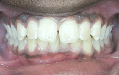 before Image