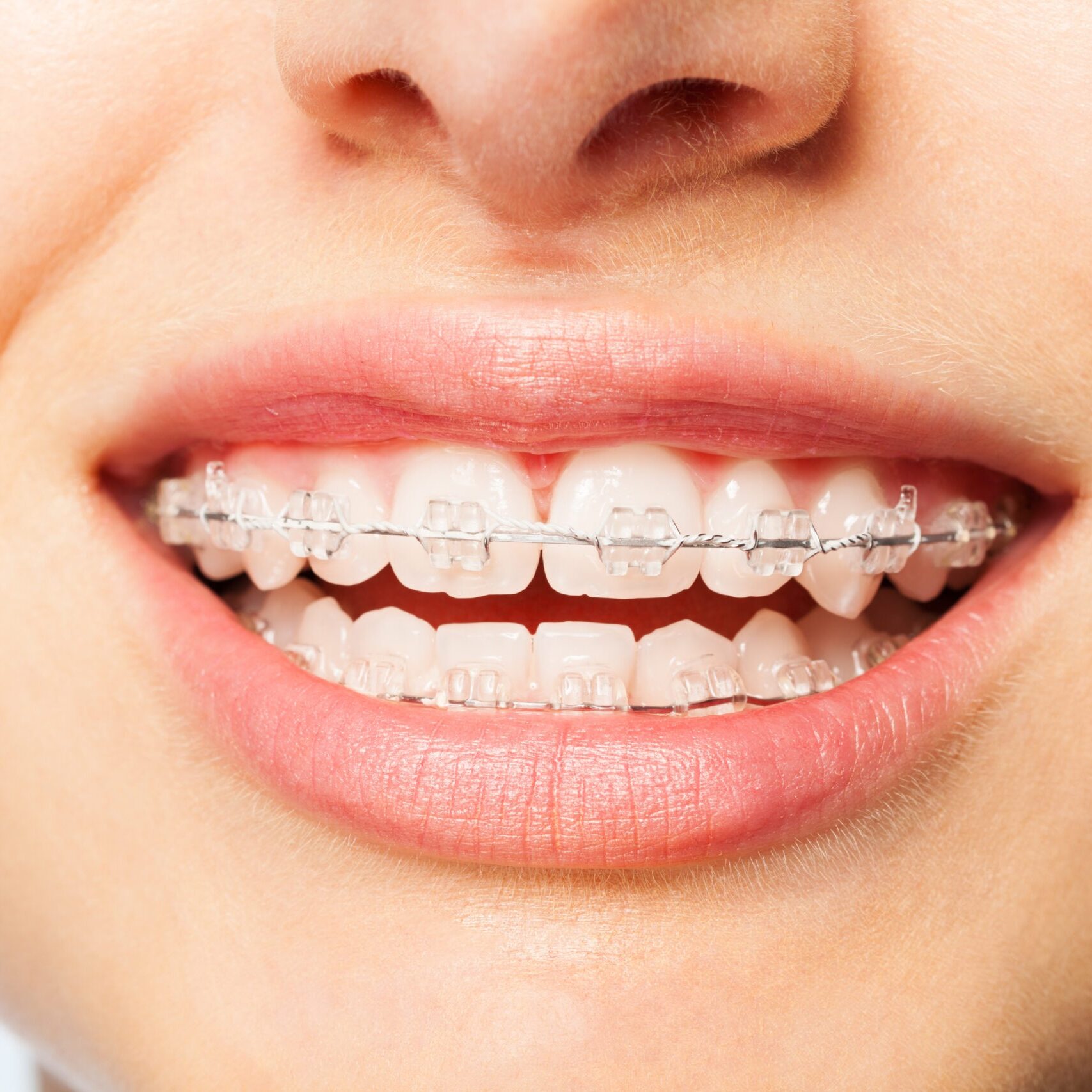 willowick orthodontics